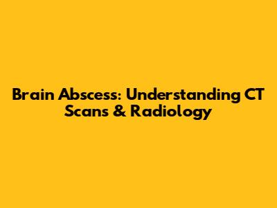 Brain Abscess: Understanding CT Scans & Radiology